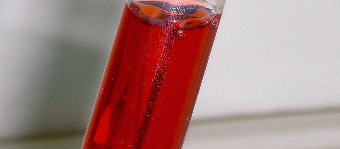 Ποιες είναι οι πιθανές αιτίες που βλέπετε αίμα στα ούρα;